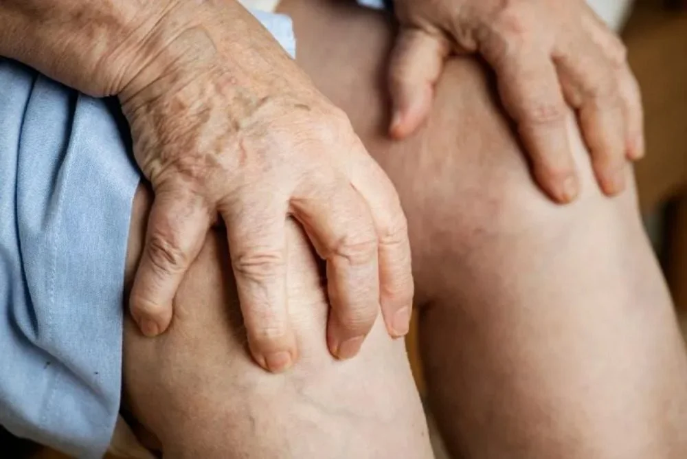 arthritis specialist in Clifton, NJ