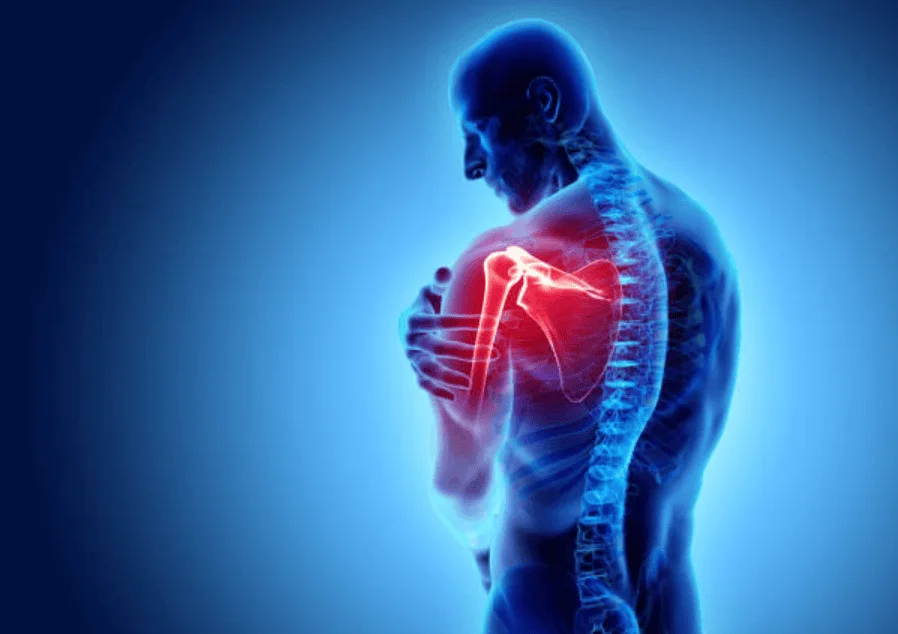 shoulder pain