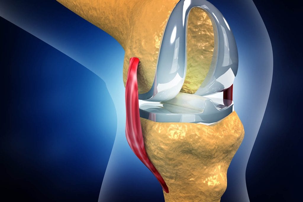 Total Knee Replacement in New York