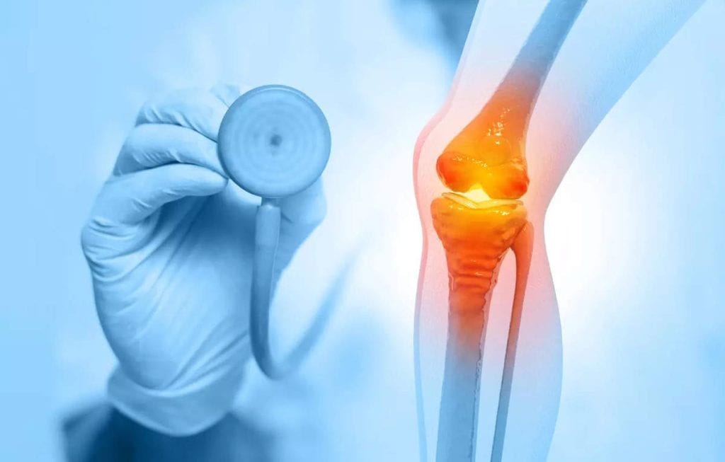 Joint Replacement