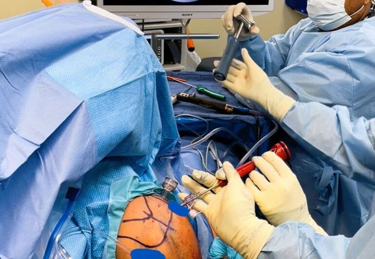Arthroscopy in New York, NY