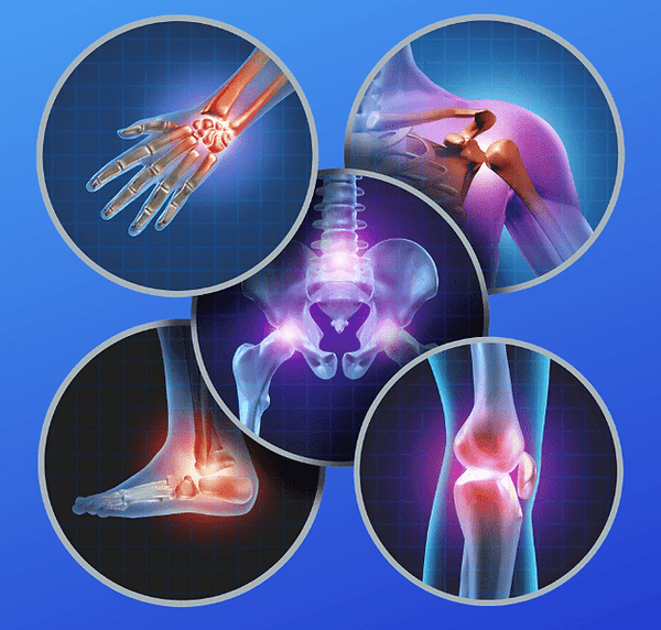 Orthopedic Trauma in Jamaica, Queens, NY