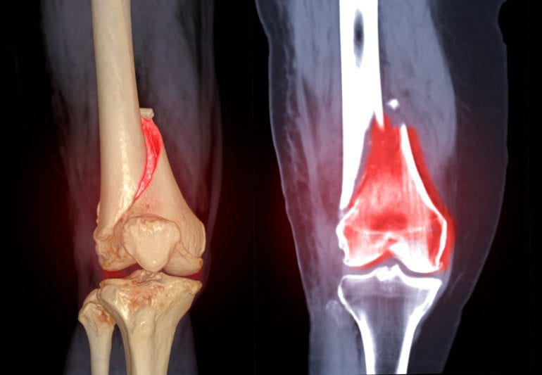 Bone injury illustration from the practice website