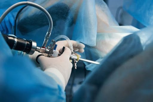 knee replacement operation